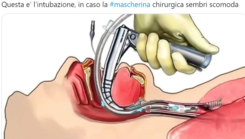 intubazione.jpg