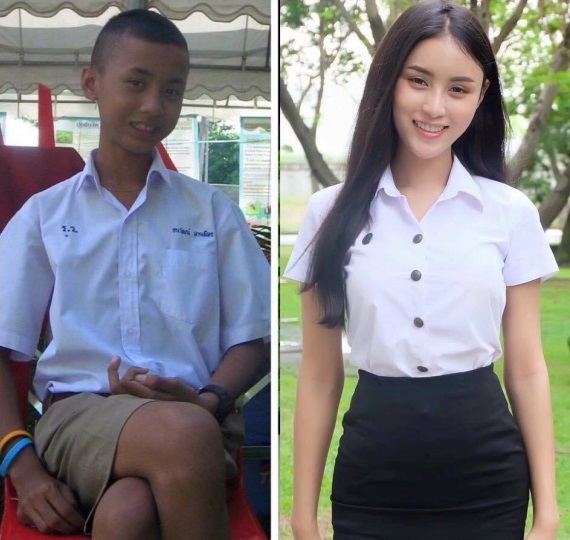 Thailand transgender before and after (1).jpg