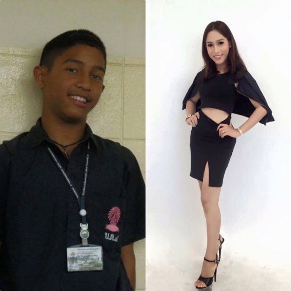 Thailand transgender before and after (6).jpg