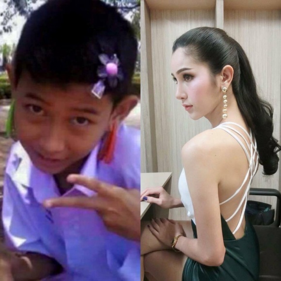 Thailand transgender before and after (3).jpg